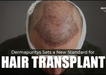 Best hair transplant clinic in Lucknow, hair restoration Lucknow, hair transplant Lucknow, Dermapuritys